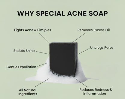 Acne Soap :- Clear Skin Starts Here – The Acne Soap That Works" 100gm